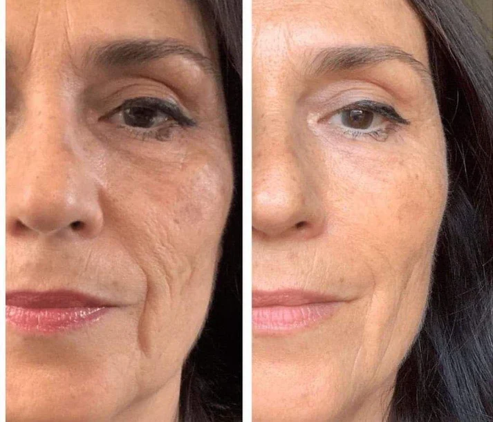 antes y despues de la aplicación del producto